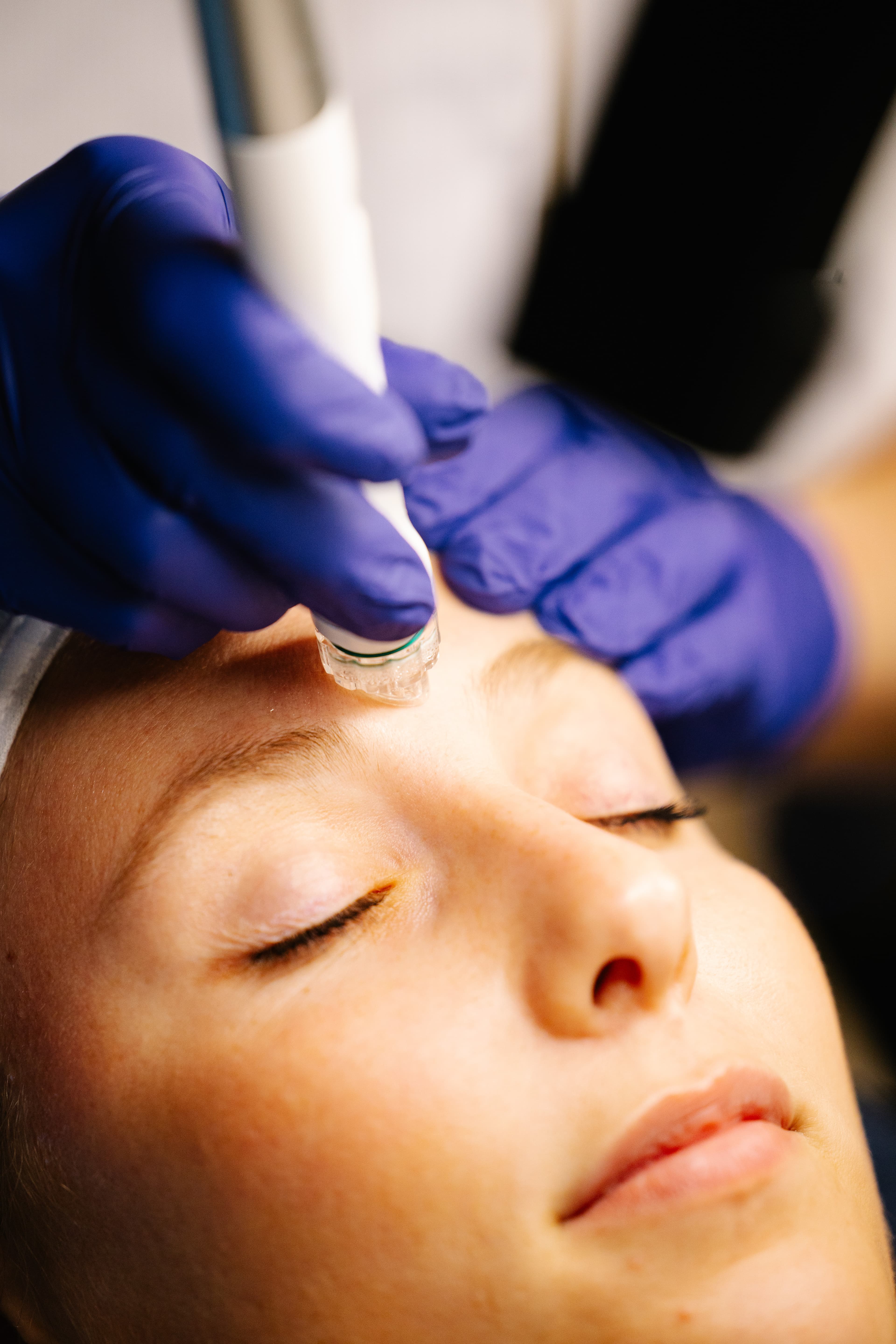 Nettoyage profond et éclat immédiat